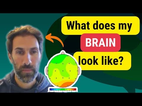 Inside the Autistic Brain – THE RESULTS ARE IN!