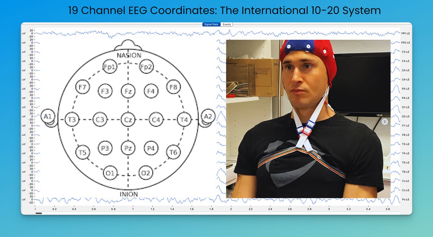 Biohacking with EEG Phenotypes: Predicting Brain Function from Electrical Patterns