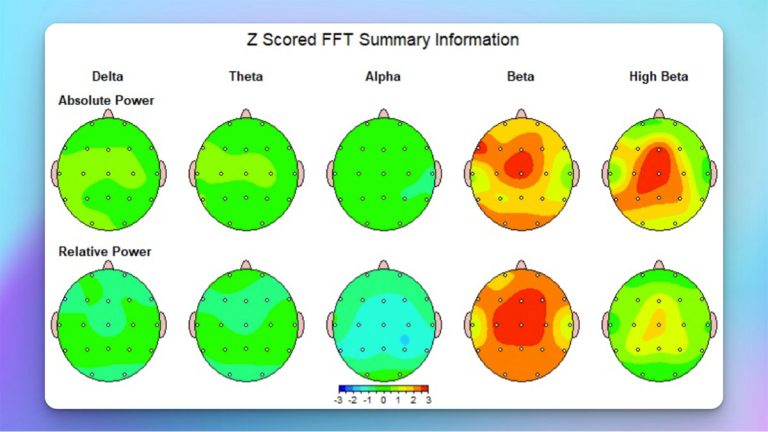 qeeg patterns