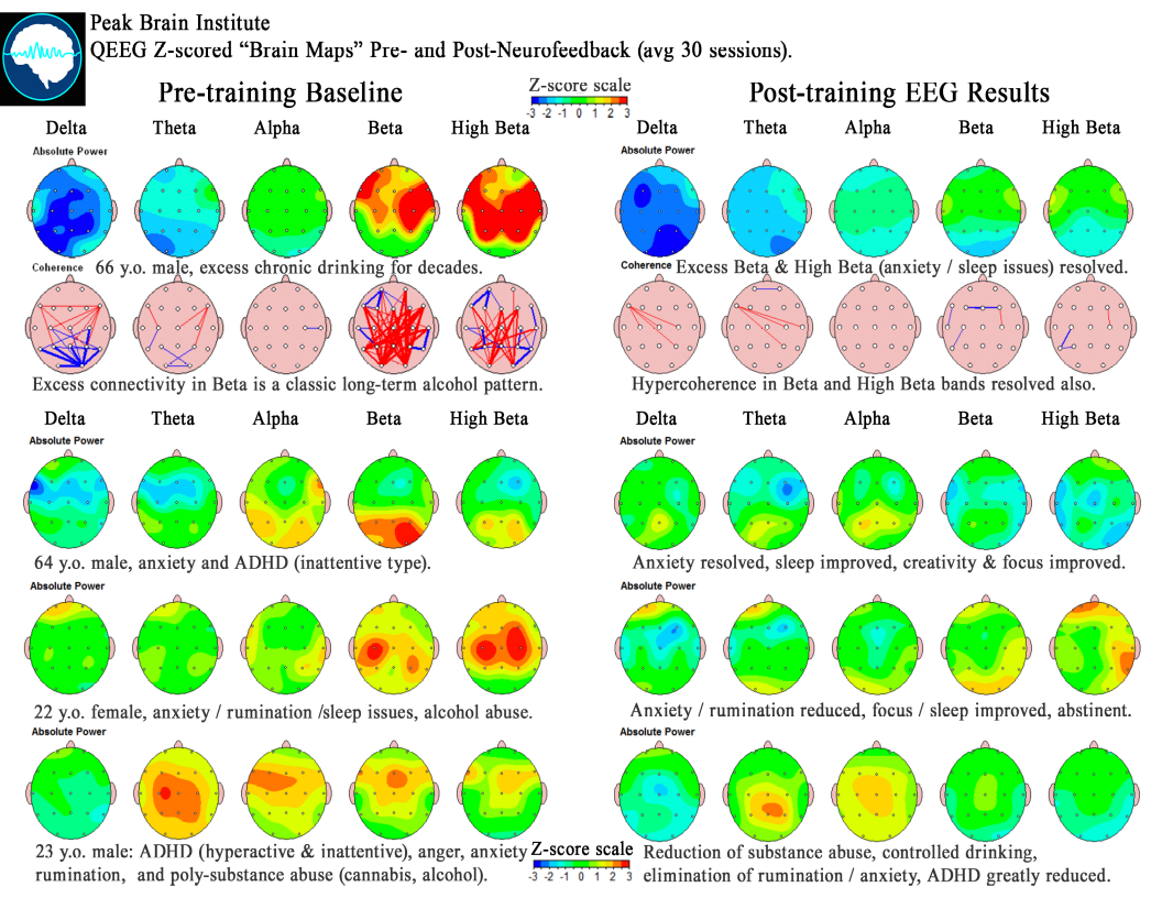 several common patterns