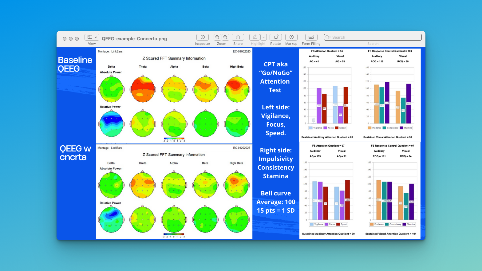 Phenotypes are impacted by medication