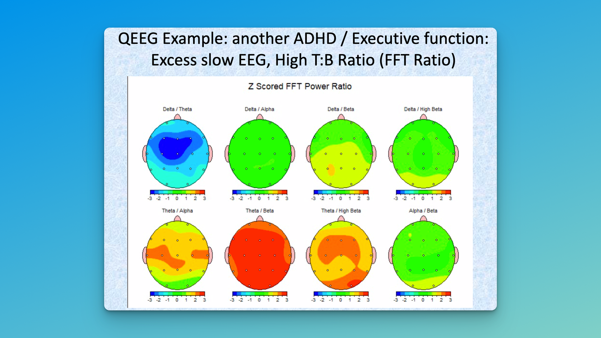 Additional ADHD and Anxiety